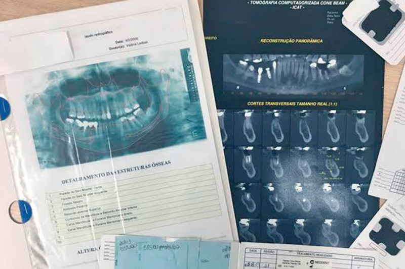 Guia prático sobre anamnese odontológica